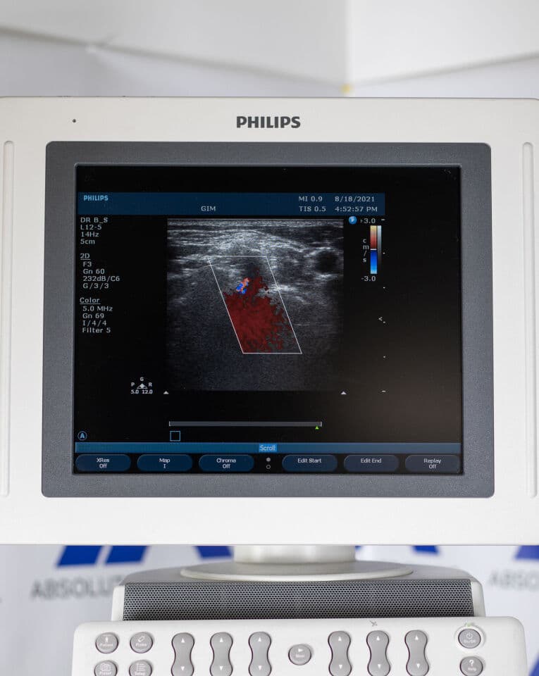 Philips HD11xe Ultrasound System thumbnail 12