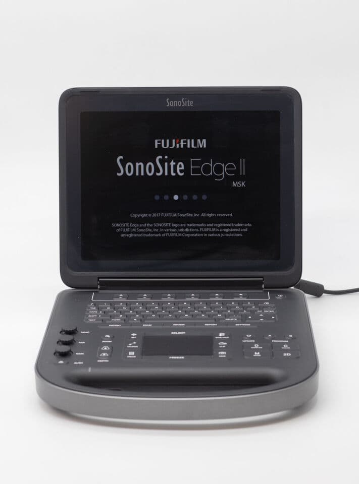 Sonosite Edge II Portable Ultrasound System thumbnail 2