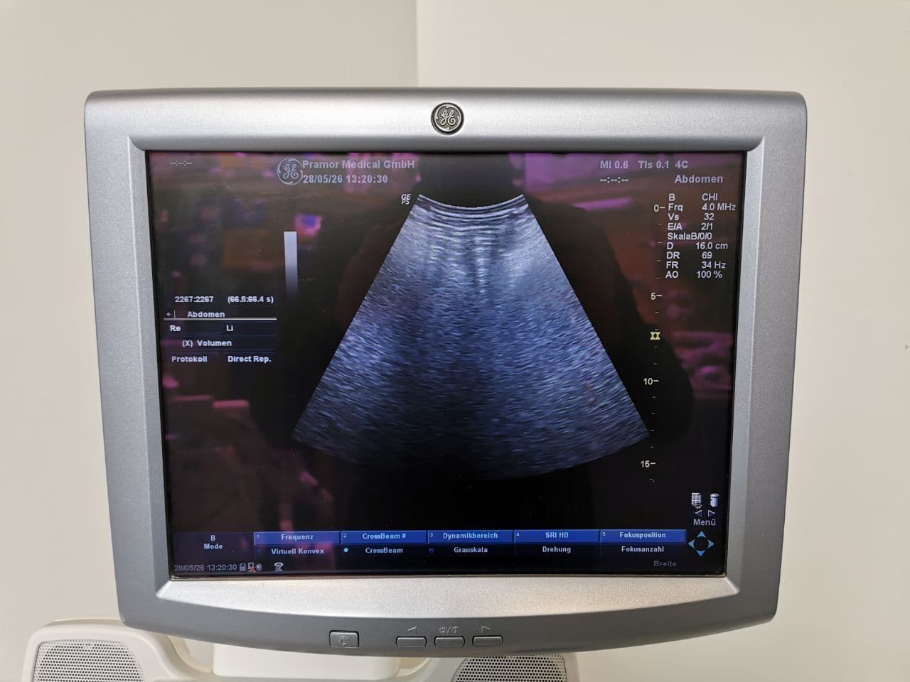 GE Healthcare 4C Convex Ultrasound Probe thumbnail 8