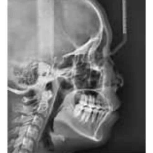 Vatech PaX-i Pan/Ceph Dental X-Ray System thumbnail 5