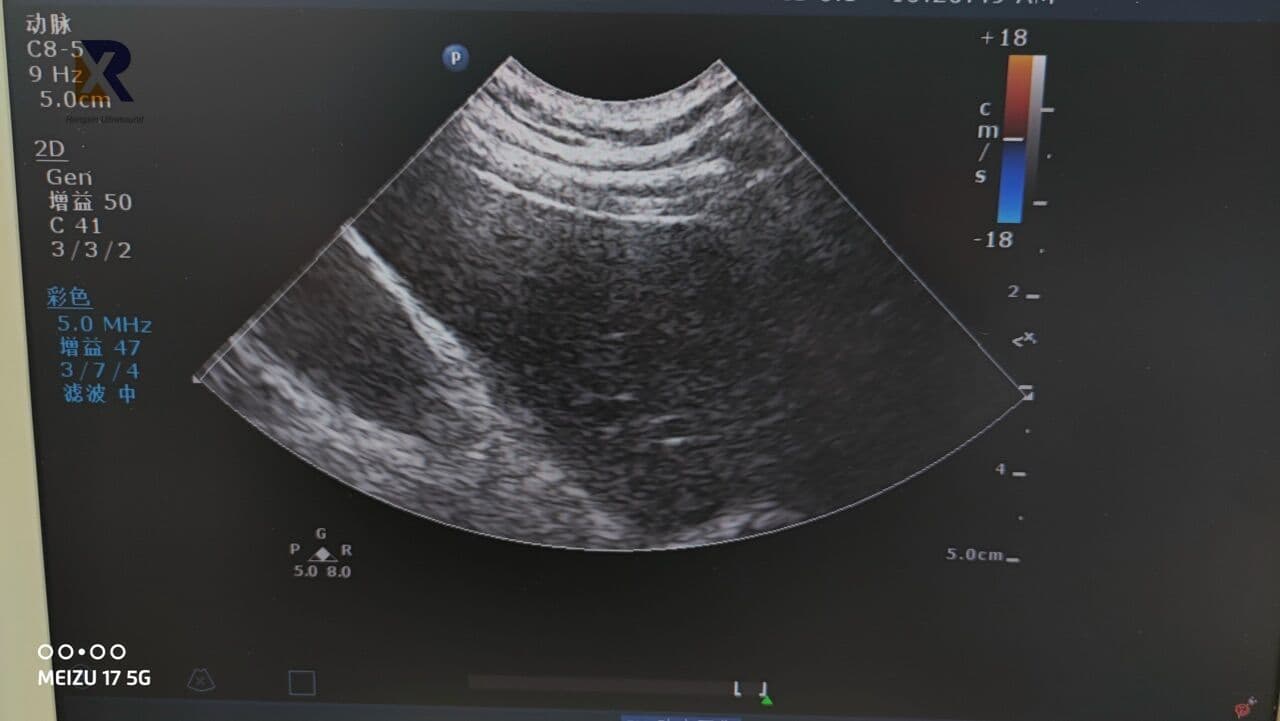 Philips C8-5 Curved Array Ultrasound Transducer for EPIQ, Affiniti, and CX50 Systems thumbnail 4