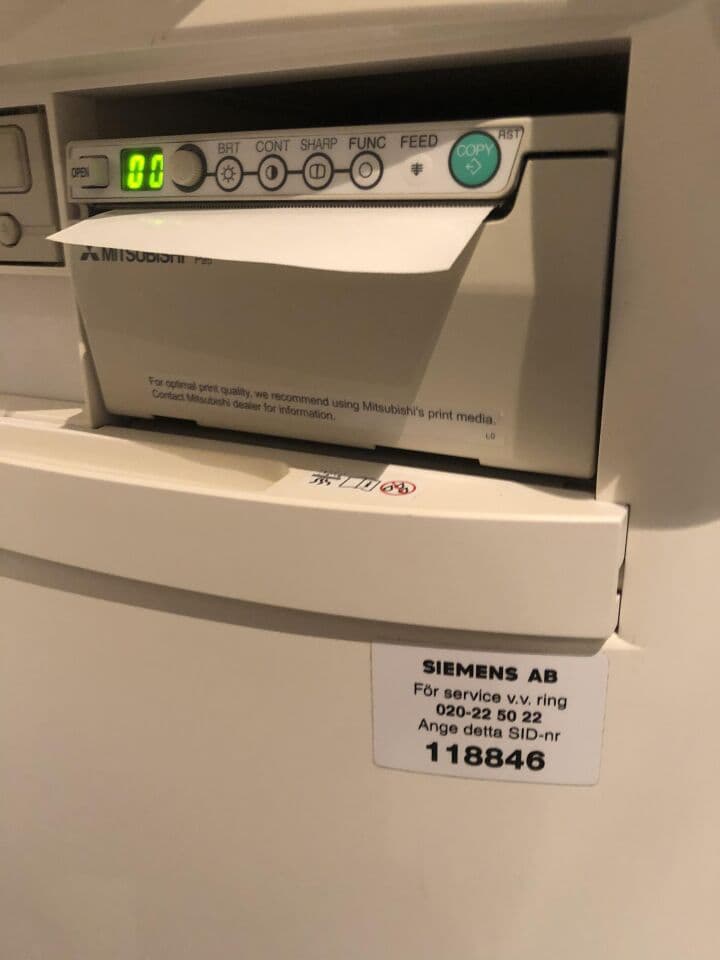 Siemens Acuson X300 General Ultrasound System thumbnail 5
