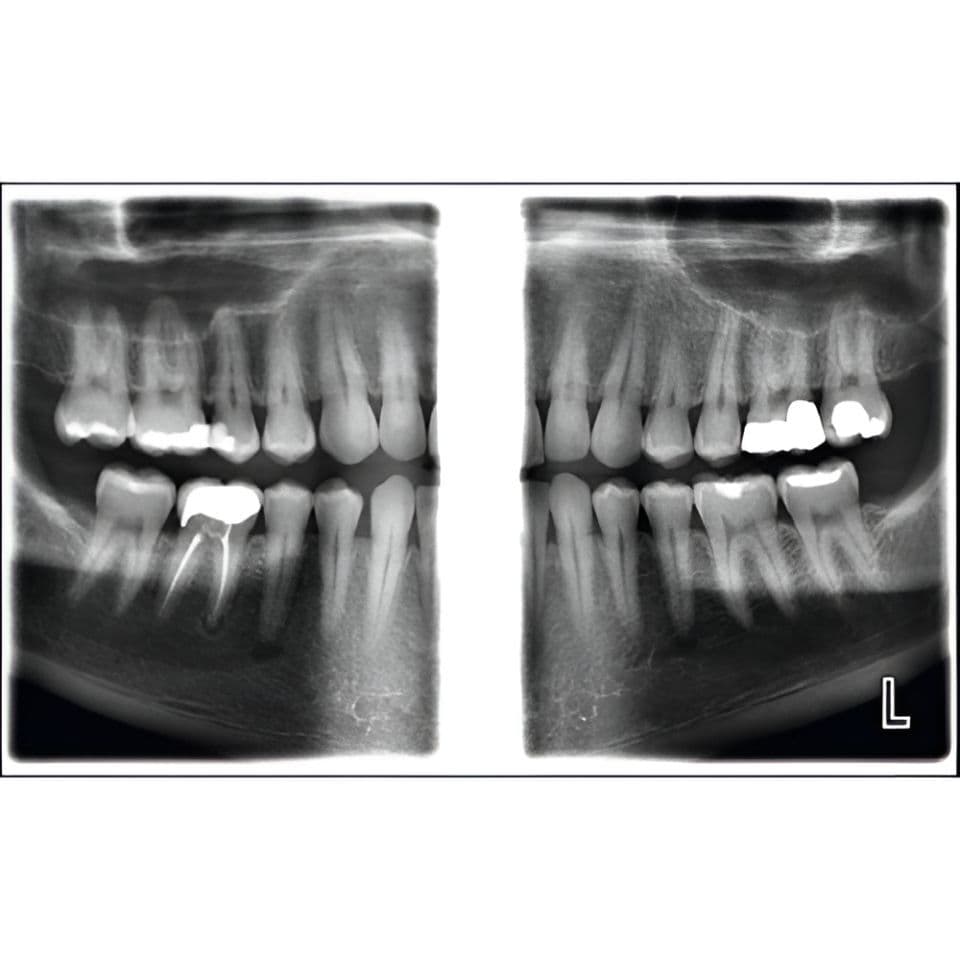 Planmeca ProMax Pan Dental X-Ray System thumbnail 12