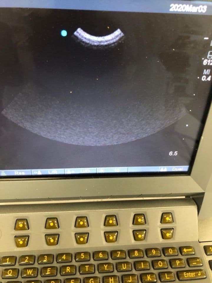 Sonosite C11 Ultrasound Transducer Probe thumbnail 2