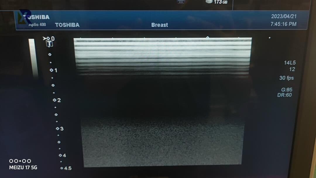Toshiba PLT-1005BT Linear Array Ultrasound Transducer thumbnail 4