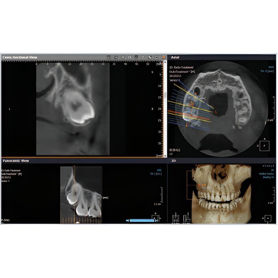 RAYSCAN Alpha Pan + CBCT (10x10 FOV) 3D Dental X-Ray System thumbnail 2