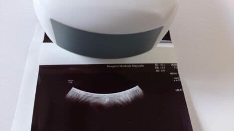 GE EM6C 4D Convex Matrix Ultrasound Transducer thumbnail 2