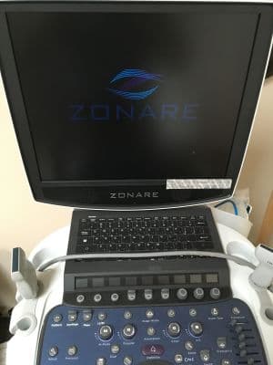 Zonare ZS3 Shared Service Ultrasound System thumbnail 6