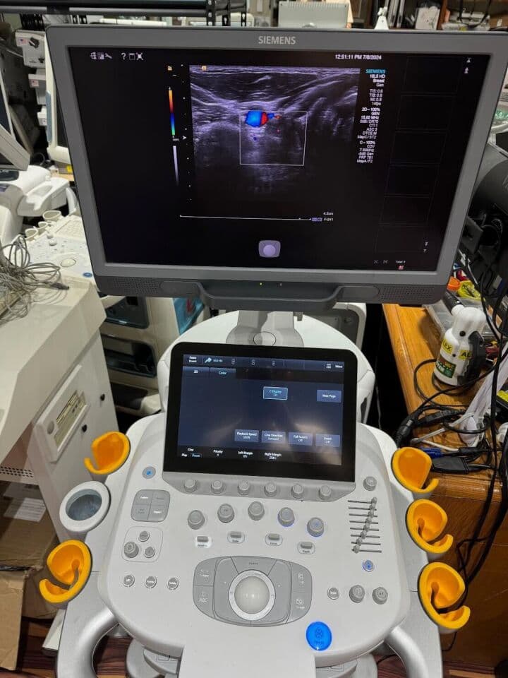 Siemens Acuson Antares S3000 Ultrasound System thumbnail 3