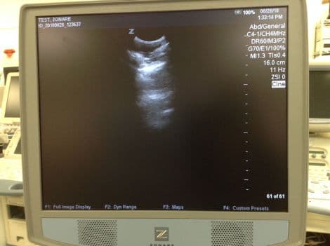 Zonare Z1 General Ultrasound System with Cart and Scan Engine thumbnail 4
