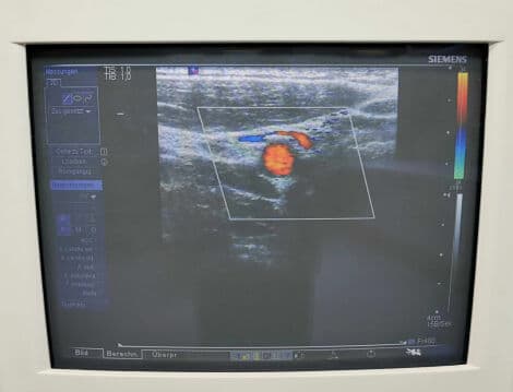 Vascular Imaging Linear Ultrasound Transducer — Siemens VF13-5 thumbnail 4