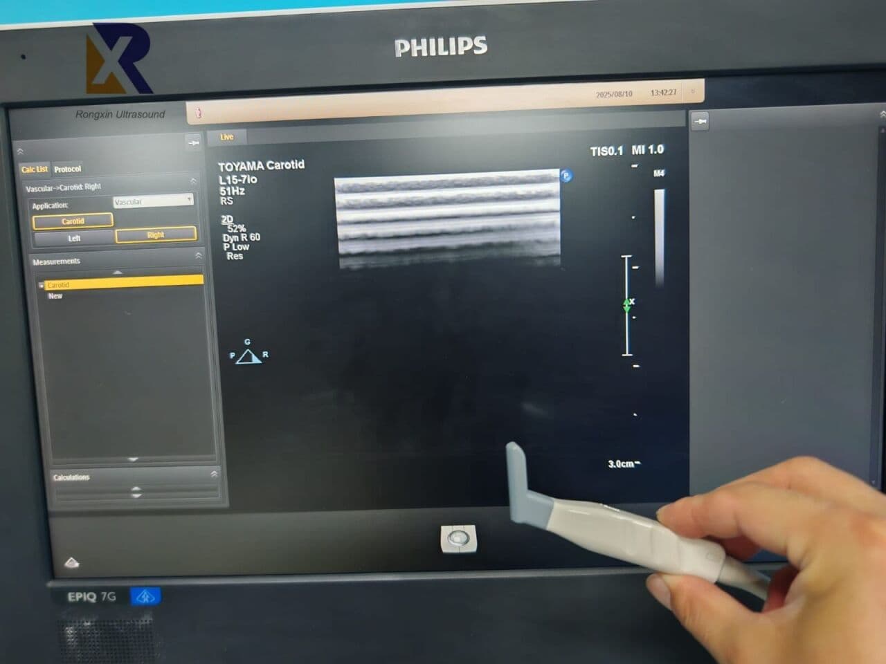 Philips EPIQ 7G Premium General Ultrasound Machine thumbnail 2
