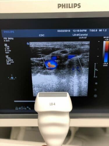 Philips L8-4 Linear Ultrasound Transducer Probe image 1