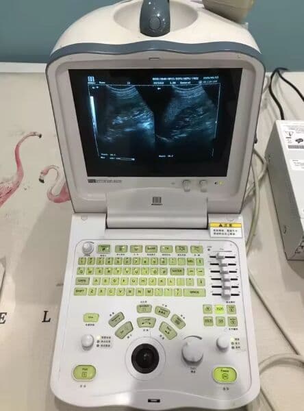Mindray DP6600 Portable Ultrasound Scanner with Convex Probe thumbnail 2