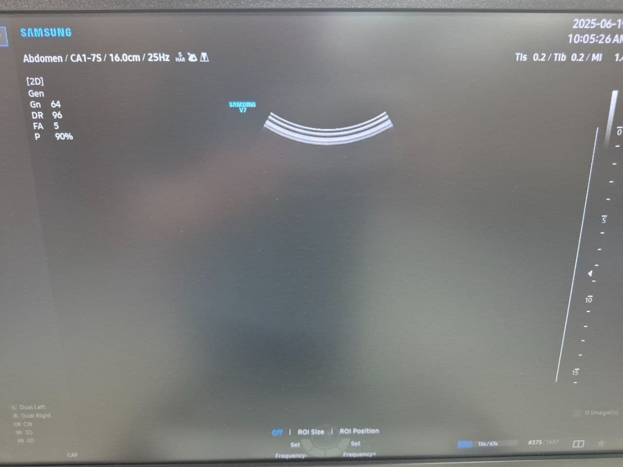 Convex Ultrasound Transducer — Samsung CA1-7S thumbnail 5