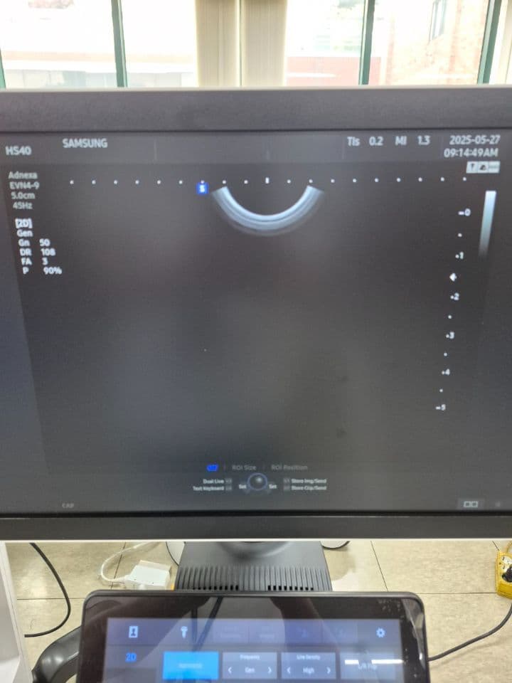Samsung EVN4-9 Endocavity Ultrasound Transducer thumbnail 6