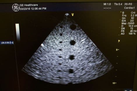 GE 3S-RS Phased Array Cardiac Ultrasound Transducer thumbnail 4