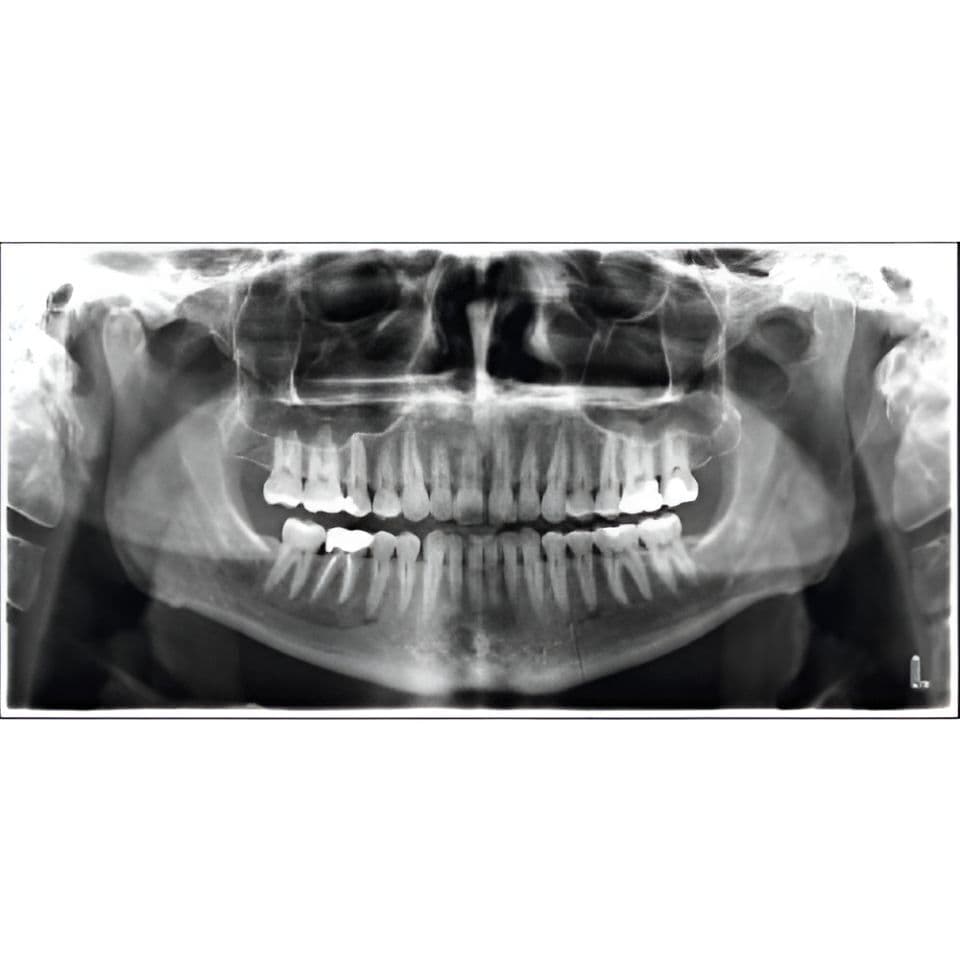 Planmeca ProMax Pan Dental X-Ray System thumbnail 8