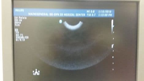 Philips C8-4v Endovaginal Curved Array Ultrasound Transducer thumbnail 3