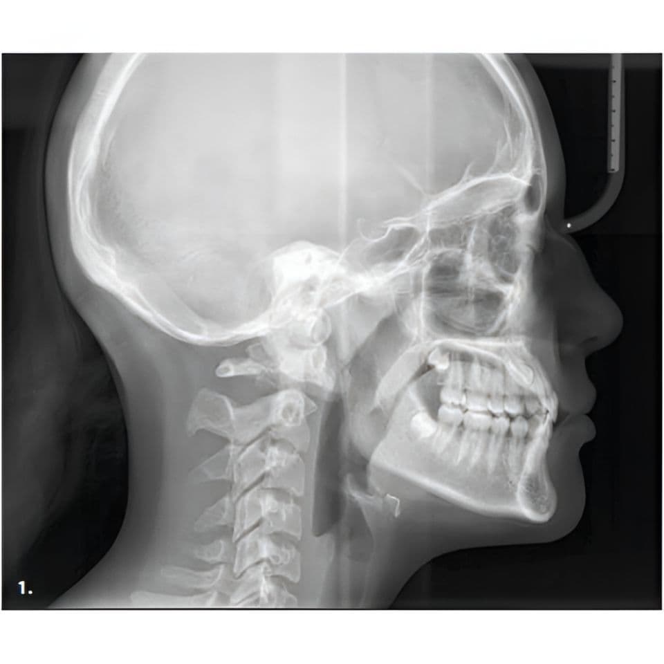 MyRay Hyperion X9 PRO Pan/Ceph/CBCT Dental X-Ray with 13x16 FOV thumbnail 7