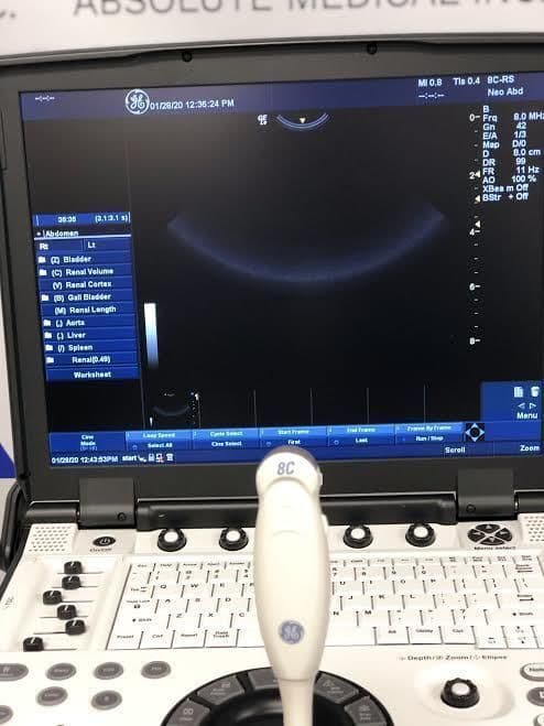 GE 8C-RS Micro Convex Ultrasound Transducer thumbnail 2