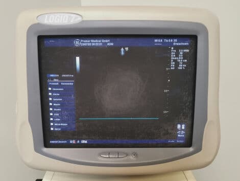 GE Logiq 7 Cardiac Ultrasound System thumbnail 9