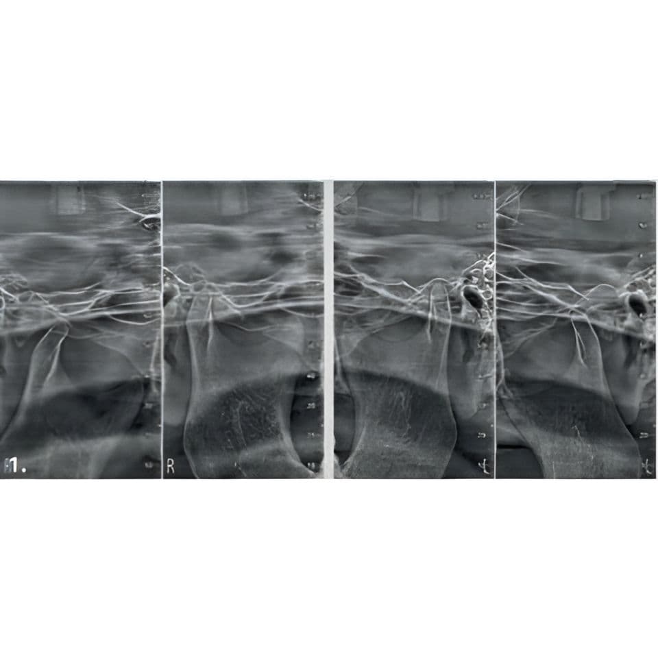 MyRay Hyperion X9 PRO Pan/Ceph/CBCT Dental X-Ray with 13x16 FOV thumbnail 10