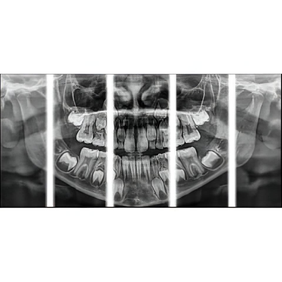 Carestream CS8100 Pano Panoramic Dental X-Ray System thumbnail 2