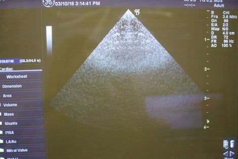 GE M3S Sector Matrix Array Ultrasound Transducer thumbnail 4
