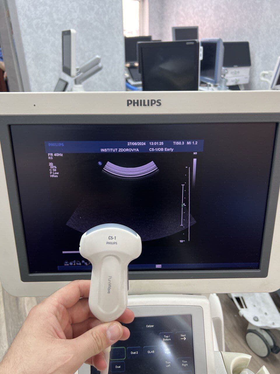 Philips iU22 Ultrasound System image 1
