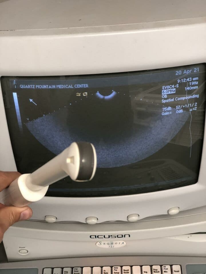 Acuson Sequoia 512 Ultrasound System with EV8-C4 Endocavitary Probe thumbnail 3