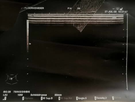 Linear Ultrasound Probe for Superficial Imaging — Hitachi EUP-L53 thumbnail 2