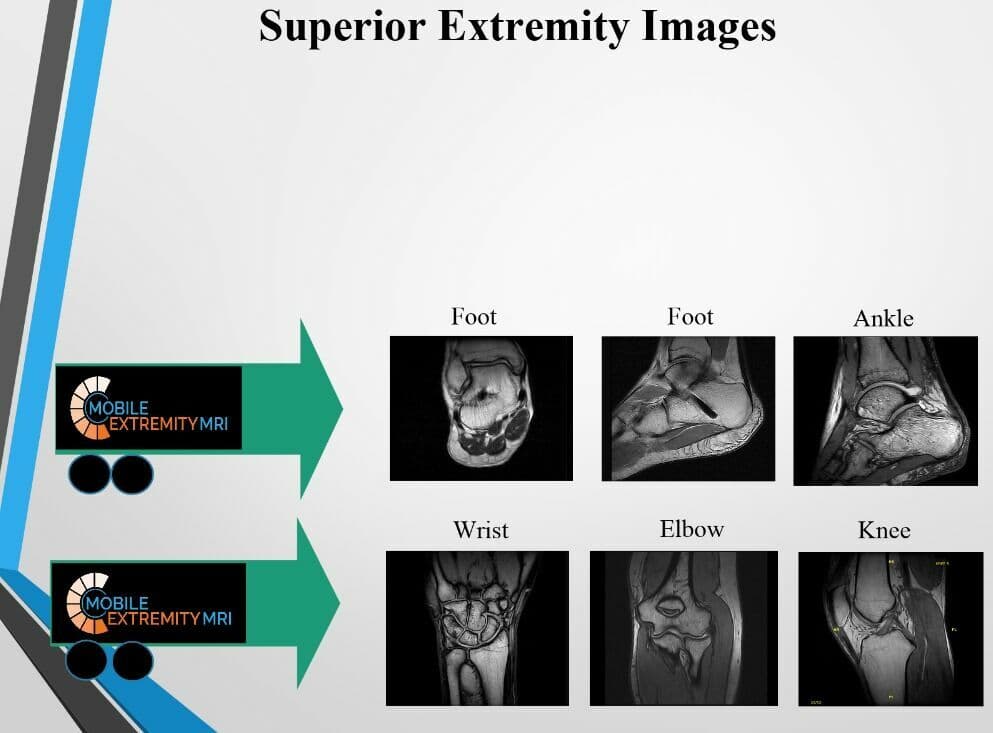 Esaote Oscan XLT — Mobile MRI System in Trailer thumbnail 3