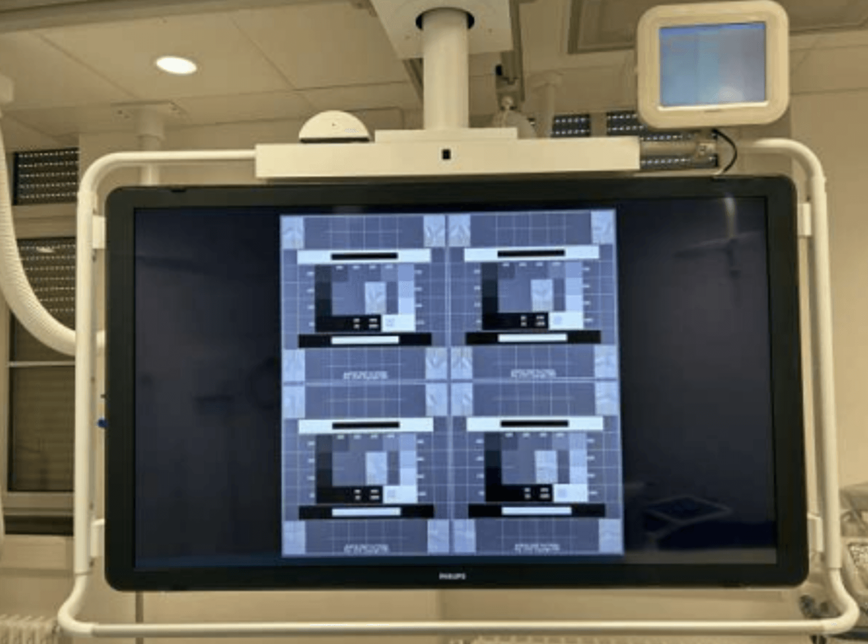 Philips Azurion 7 M20 thumbnail 4
