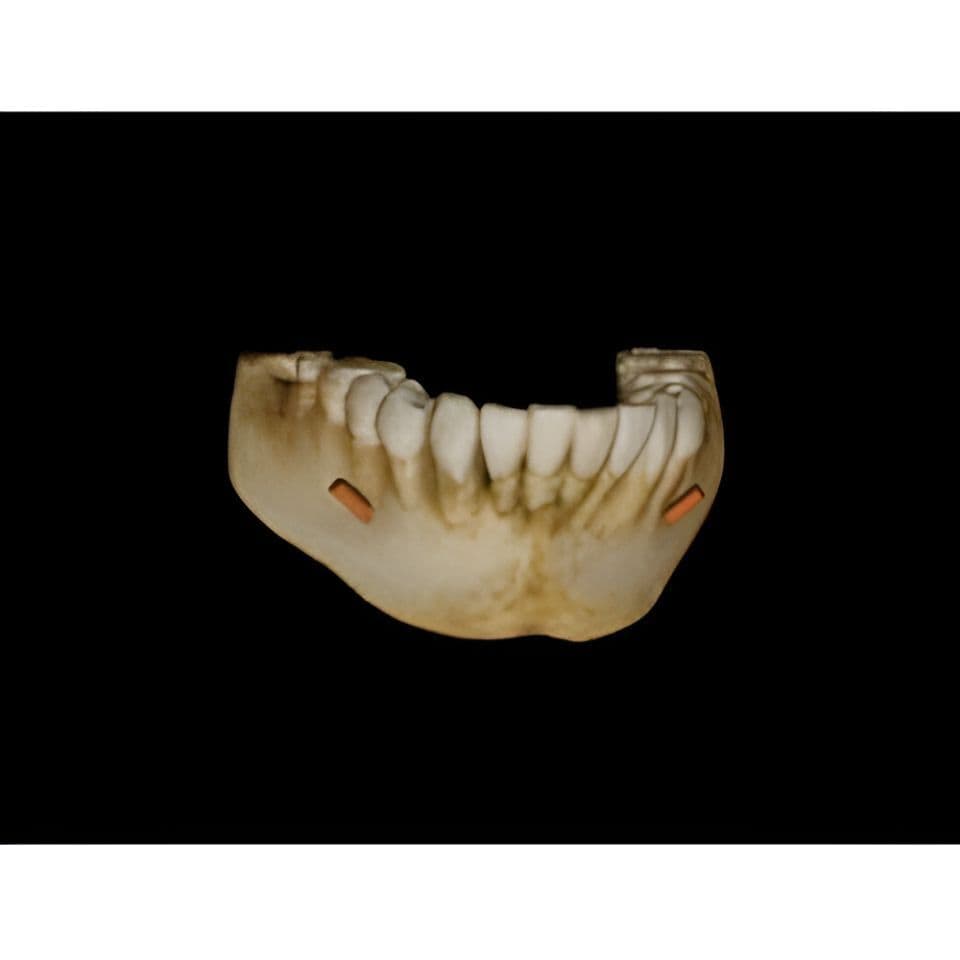 Carestream CS9000 Pan/CBCT 3D Dental X-Ray System thumbnail 8