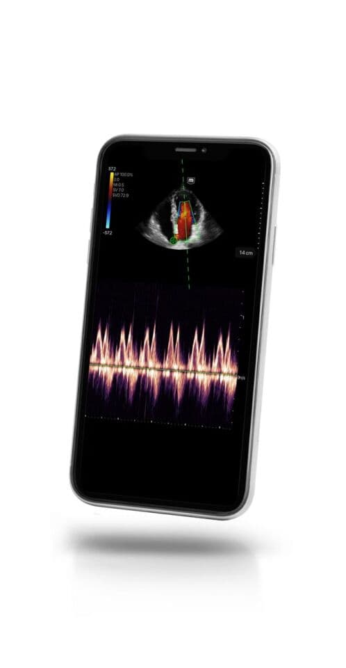 Mindray TE Air Wireless Handheld Ultrasound System thumbnail 2