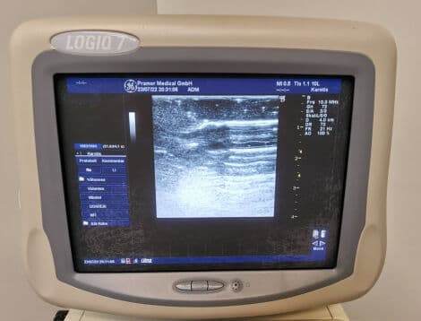 GE Logiq 7 Cardiac Ultrasound System thumbnail 6