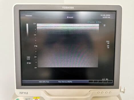 Diagnostic General Ultrasound System — Toshiba Aplio XG (SSA-780A) thumbnail 6
