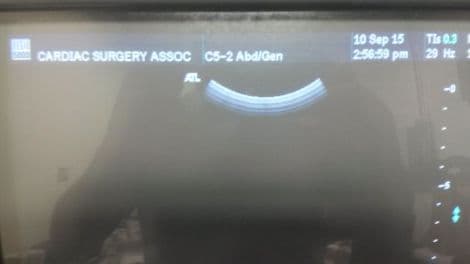 ATL C5-2 Curved Linear Ultrasound Transducer thumbnail 3