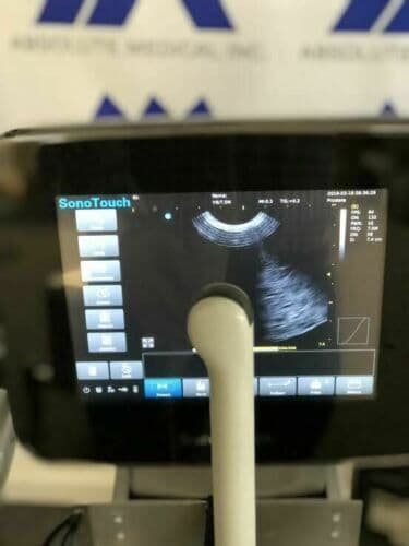 CHISON Sonotouch 30 Portable Ultrasound System with Touchscreen Interface thumbnail 6