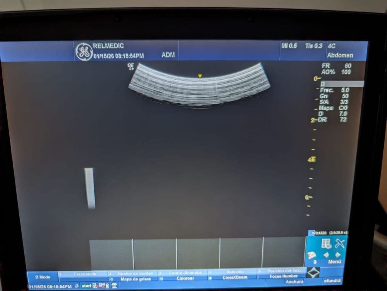 GE 4C-RS Convex Ultrasound Transducer thumbnail 6