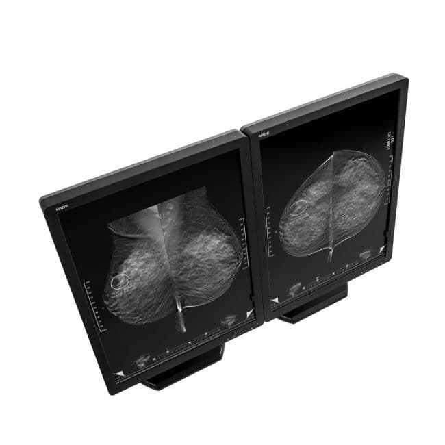 5MP Monochrome Diagnostic Display Monitor — WIDE MX50N thumbnail 3