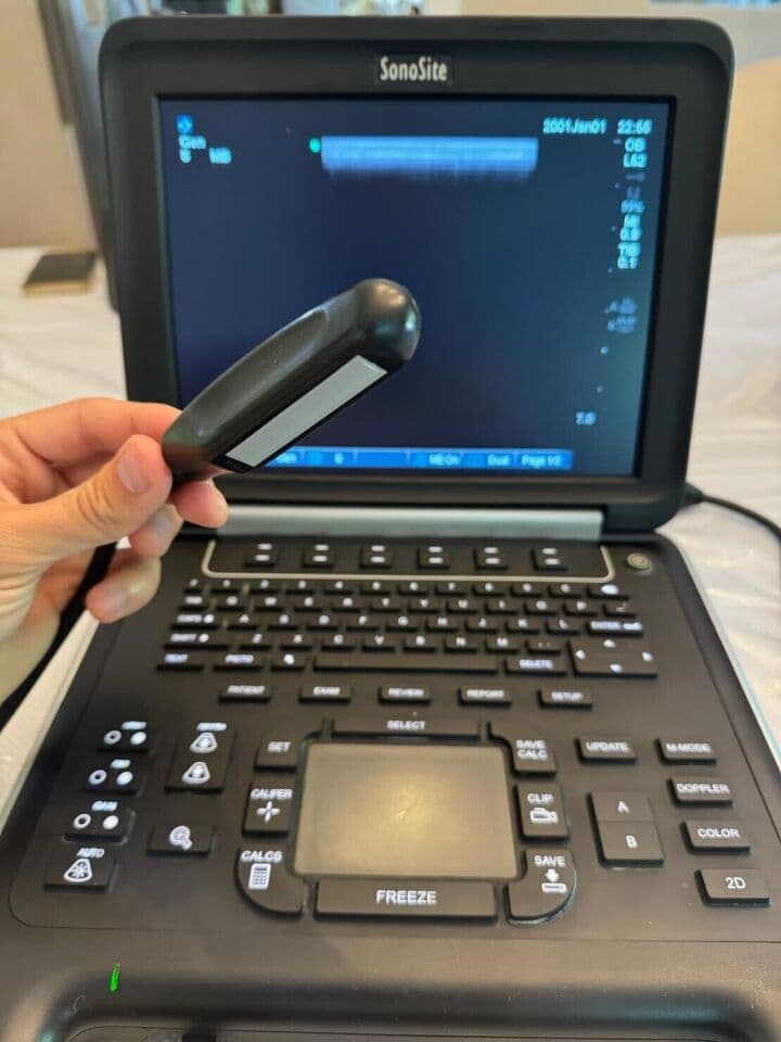 Sonosite Edge Veterinary Ultrasound System thumbnail 3
