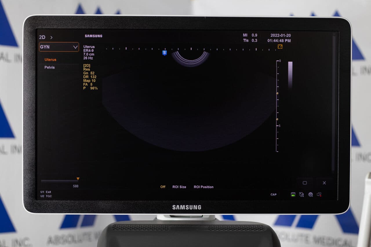 Samsung HS50 Diagnostic Ultrasound System thumbnail 4