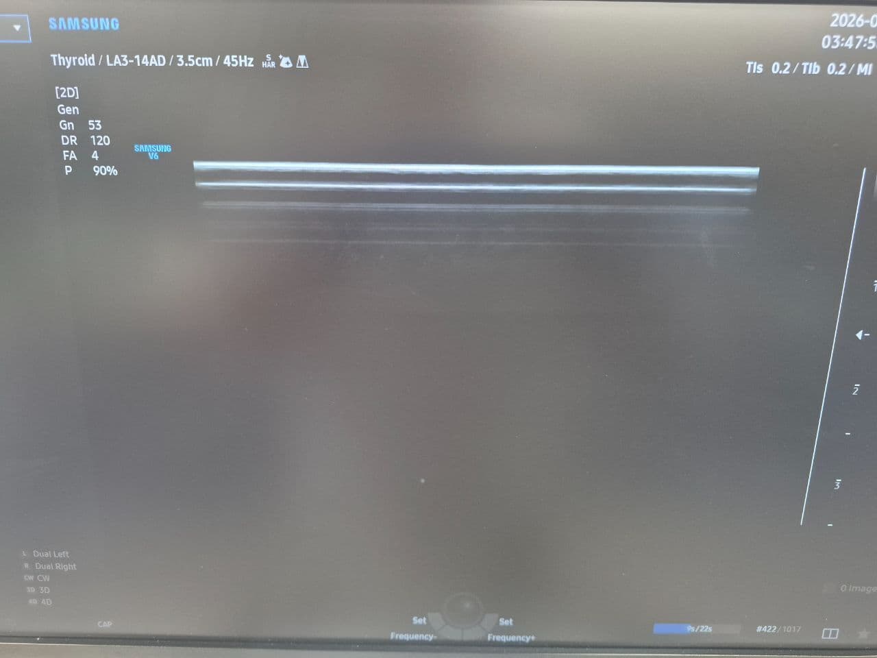 Samsung LA3-14AD Linear Array Ultrasound Transducer thumbnail 4
