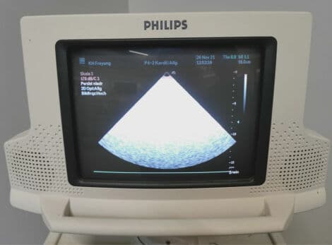 Philips P4-2 Phased Array Cardiac Ultrasound Probe thumbnail 3