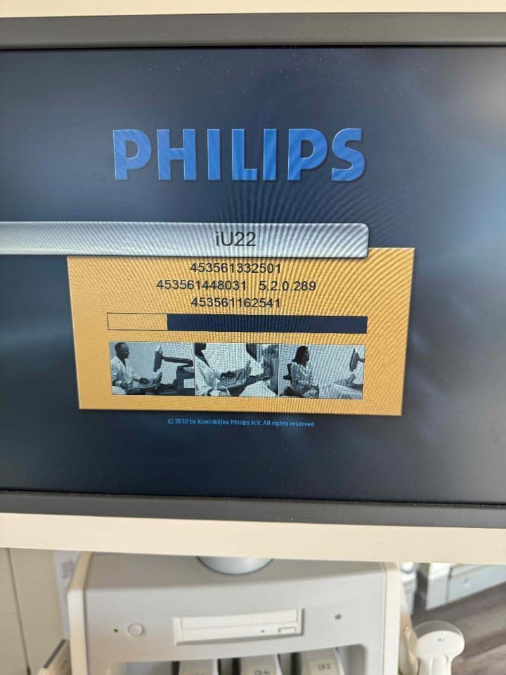 Philips iU22 Shared Service Ultrasound System thumbnail 3