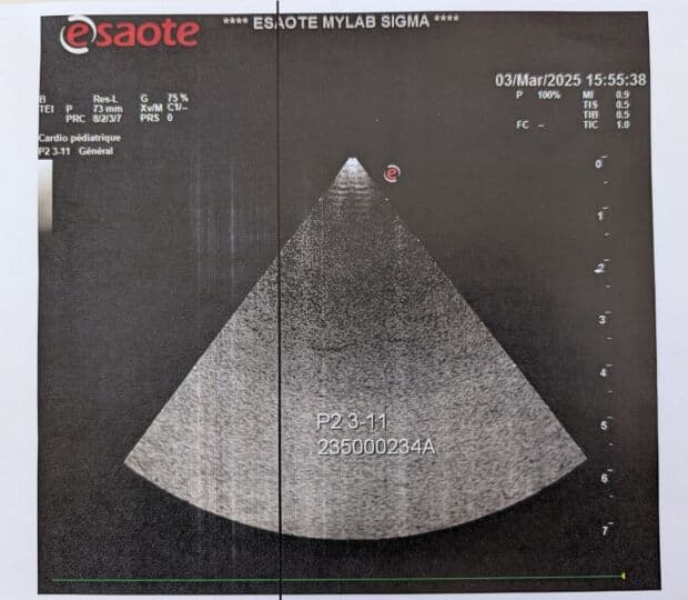 Esaote P2 3-11 Sector Ultrasound Transducer thumbnail 5