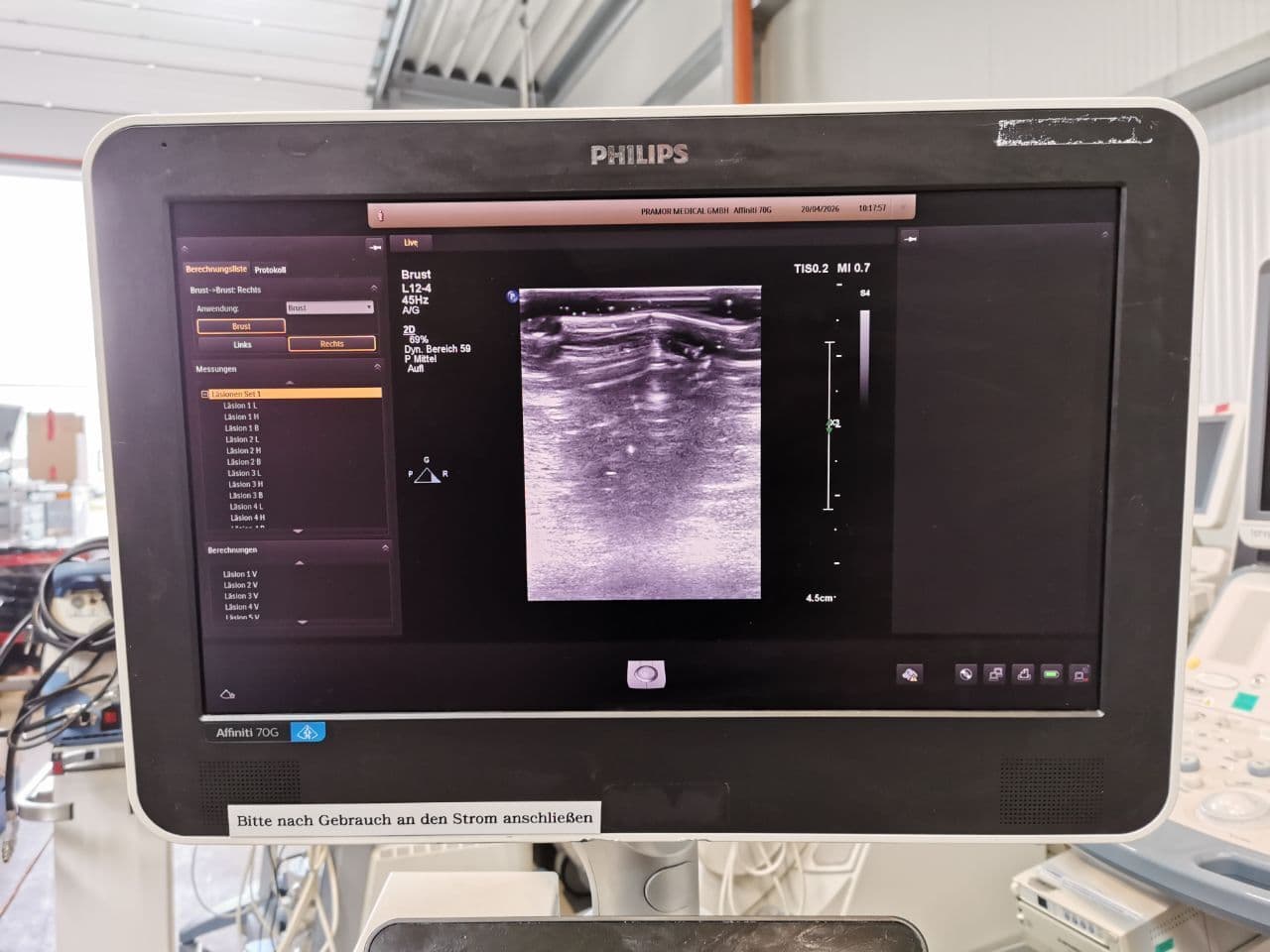 Philips L12-4 Linear Array Ultrasound Transducer thumbnail 6