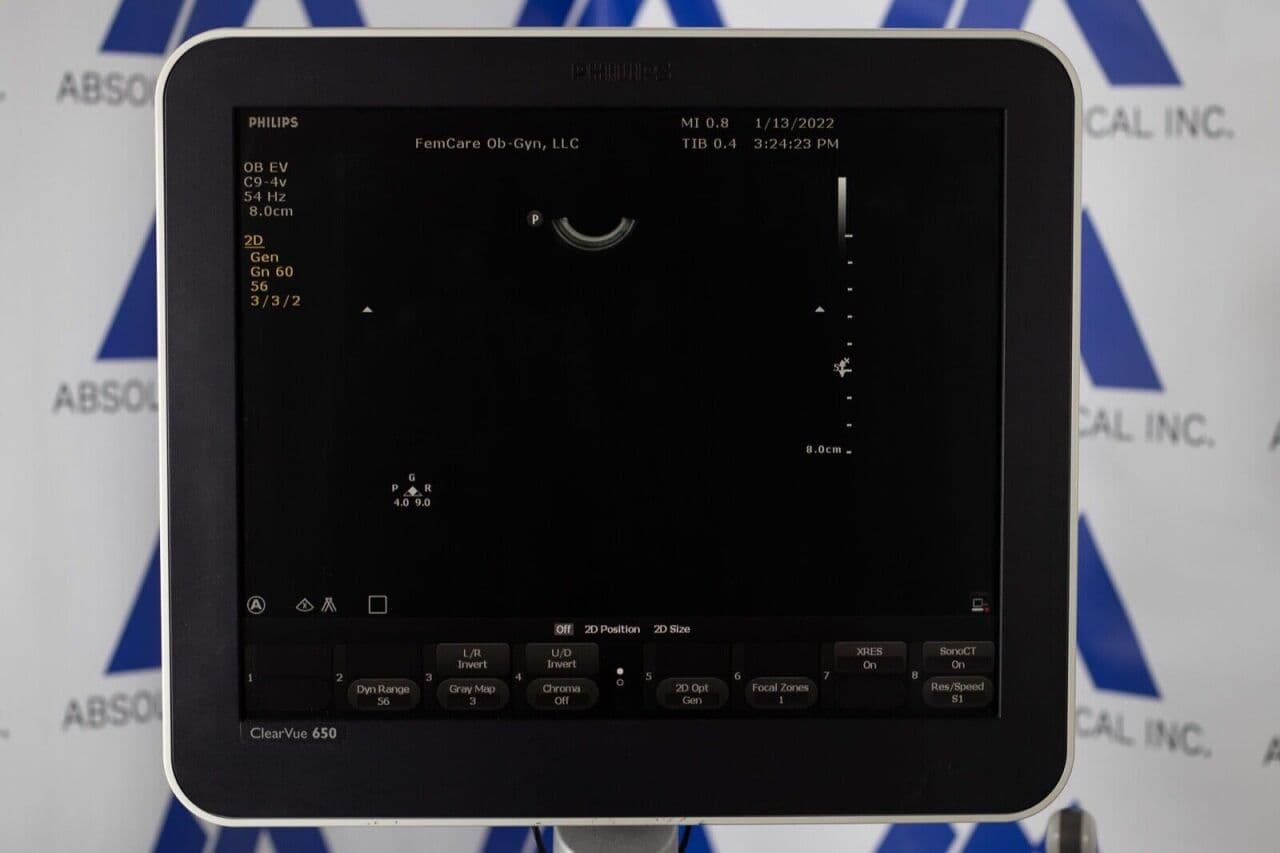 Philips ClearVue 650 OB/GYN Ultrasound System thumbnail 10